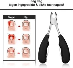 Merkloos Nageltang Met Gebogen Bek + Vijl - Nagelknipper Set - Pedicure Set -Mode Cosmetica Winkel 1200x1117 1