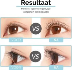 3-Delige Elektrische Wimperkruller Set – Incl. Wimperserum & Wimperborstel – Wimperlifting Set – Lash Lift – Lange, Gekrulde En Volle Wimpers – Eyelash Curler -Mode Cosmetica Winkel 1200x1163 8
