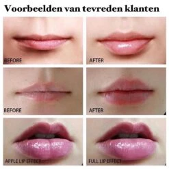BenjaBeauty Lip Plumper - Lippen - Lipstick - Lippenbalsem - Rood - Wit -Mode Cosmetica Winkel 1200x1200 704