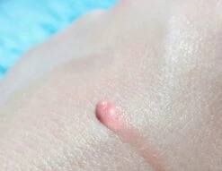 Biodermal Sun Lipbalm SPF25 - Tube 12 Ml - Natural Pink - Lippenbalsem -Mode Cosmetica Winkel 1200x927